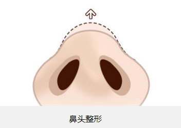 北京植眉醫(yī)院推薦：高新及新生，專業(yè)醫(yī)護(hù)技藝令人贊嘆！