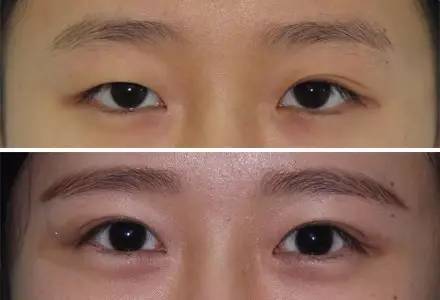 寧波瘦背整形醫(yī)院排行榜【3家】 寧波瘦背整形醫(yī)院排行榜【3家】