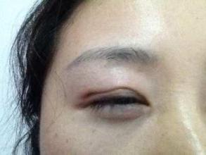 廣州隆鼻手術(shù)：挑選最好的醫(yī)生，口碑盤點(diǎn)！是否有你最滿意的專家？