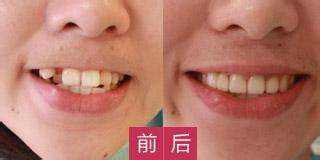 哪家醫(yī)院適合進(jìn)行磨骨手術(shù)？江城和美立方廣受網(wǎng)友推崇！