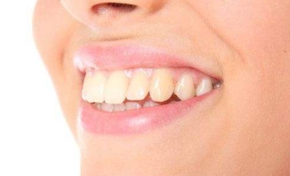 威海整形醫(yī)院評(píng)價(jià)推薦：當(dāng)?shù)赜锌诮员腡op名單，歡迎考慮威海整形之旅！