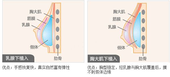 宜賓最佳雙眼皮整形醫(yī)院推薦！這七家美容院你絕不能錯(cuò)過