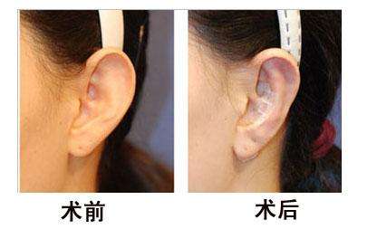 杭州首家頂級玻尿酸修復(fù)醫(yī)院:珠兒美容醫(yī)院實(shí)力獲得廣泛認(rèn)可 杭州首家頂級玻尿酸修復(fù)醫(yī)院:珠兒美容醫(yī)院實(shí)力獲得廣泛認(rèn)可