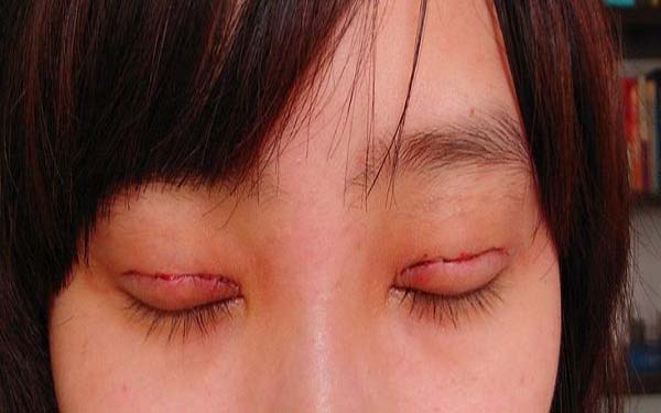 成都整形醫(yī)院修復(fù)隆鼻排行榜：前五強(qiáng)醫(yī)療機(jī)構(gòu)值得推薦！