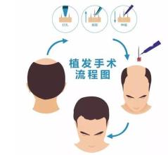 昆明哪家隆鼻醫(yī)院比較靠譜？【10所信譽極高的醫(yī)療機構(gòu)】