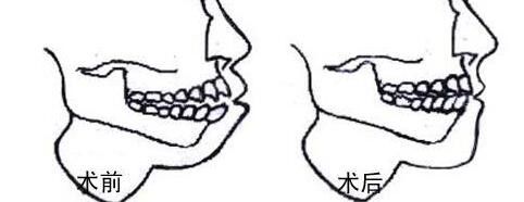 提供重慶哪家私立醫(yī)院割雙眼皮好？前五推薦_軍美領先，再揭秘
