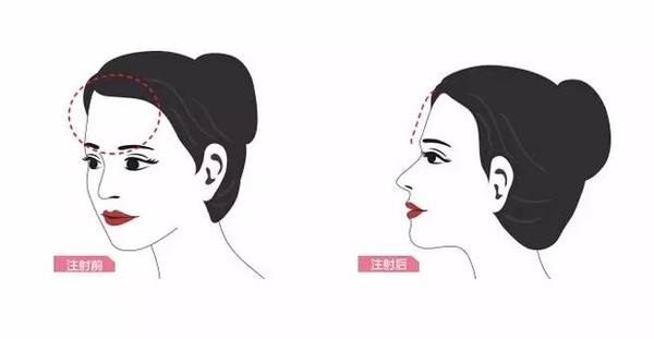 成都哪些醫(yī)院可進行磨骨手術(shù)【三家鑒定】 成都哪些醫(yī)院可進行磨骨手術(shù)【三家鑒定】