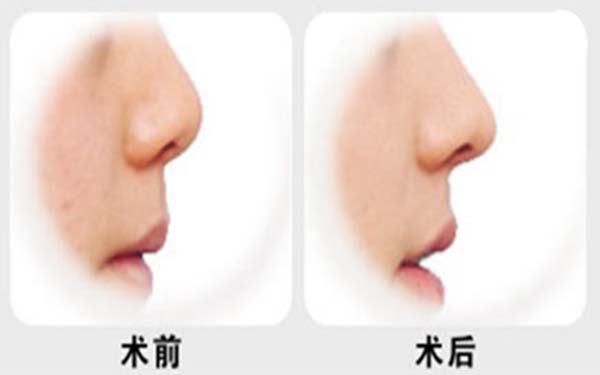 杭州專業(yè)整形美容醫(yī)院推薦榜單TOP7！熱門前三家療效不凡~