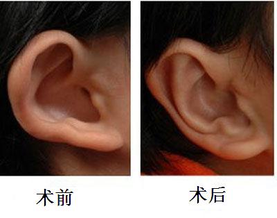 杭州口腔疾病治療首選！濃縮優(yōu)質(zhì)、平價(jià)口腔醫(yī)院一站攻略