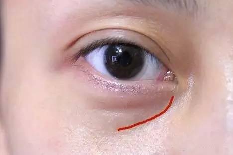沈陽哪家醫(yī)院做雙眼皮好？推薦這幾家，讓你的雙眼美麗動人起來！