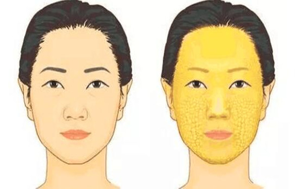 滄州治療疤痕的正規(guī)醫(yī)院推薦：專業(yè)科技祛疤，效果顯著！點(diǎn)擊了解！