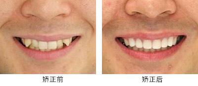 湖南綜合實(shí)力最強(qiáng)的整形醫(yī)院排行榜：這十家業(yè)內(nèi)知名醫(yī)院等你探尋！