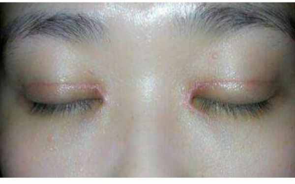 沈陽超贊的私密緊致術醫(yī)院匯總排名前十，曙光、美萊技術對比分析，各有獨特魅力！