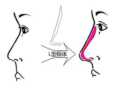 深圳最佳激光脫毛整形醫(yī)院推薦-公立醫(yī)院領(lǐng)跑市場！