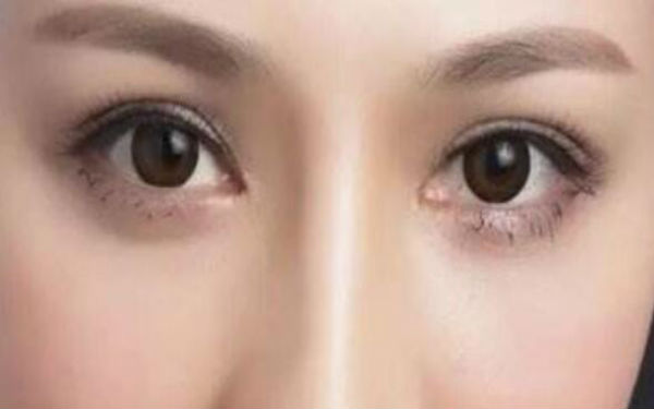邯鄲割雙眼皮醫(yī)院排行榜TOP5——萊媚儷與德枝美，你需要看看