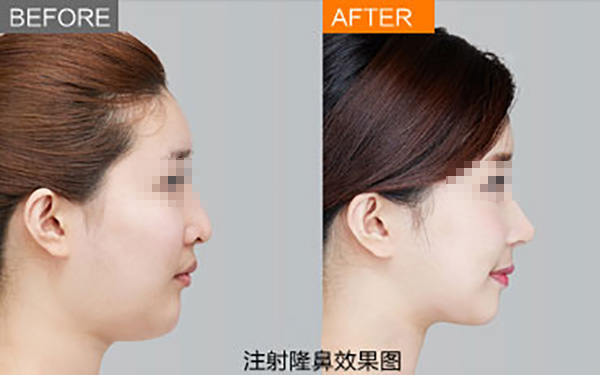 鄭州唇部整形醫(yī)院推薦：如何選擇合適的醫(yī)院？友友必看！