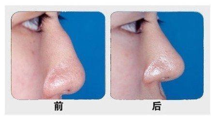 石家莊主要公立整形醫(yī)院排行榜！公辦醫(yī)療機(jī)構(gòu)最具實(shí)力！