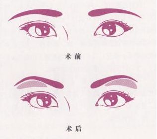 魅力煥發(fā)！常德市多家信譽(yù)醫(yī)院助你邁過(guò)疤痕困擾