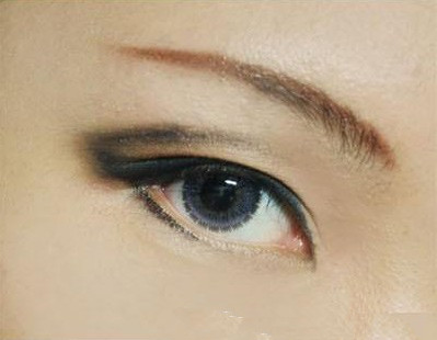 2023年綜述：漢中地區(qū)痘疤失敗修復(fù)醫(yī)院推薦排行榜前十強(qiáng)，口碑大揭秘！