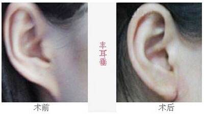 2023沈陽去魚尾紋雕塑醫(yī)院排行榜，這十家都備受口碑推崇！