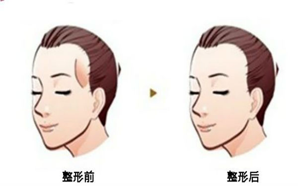 西寧顴骨矯正術(shù)：哪家醫(yī)院口碑好？2023年口碑排名前10的正規(guī)醫(yī)療整形醫(yī)院公布！
