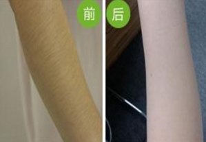 哪家南京雙眼皮手術(shù)醫(yī)院口碑好？2023年南京韓式雙眼皮手術(shù)前十名排序！