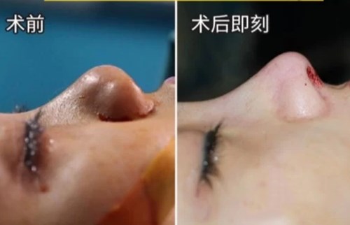 南京最熱門的環(huán)形精雕吸脂醫(yī)療美容醫(yī)院綜合推薦！2023年排行前十名大揭曉！