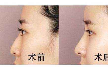 六安市受歡迎的雙眼皮整形美容醫(yī)院排行榜出爐！2023最值得信賴的明眸翹睫醫(yī)療機(jī)構(gòu)盤點(diǎn)！
