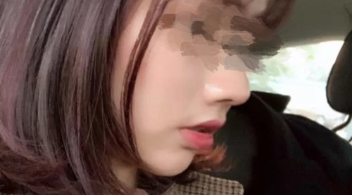 貴陽有哪些專業(yè)的磨皮去痘印醫(yī)院？2023年TOP10推薦實(shí)力醫(yī)院揭曉