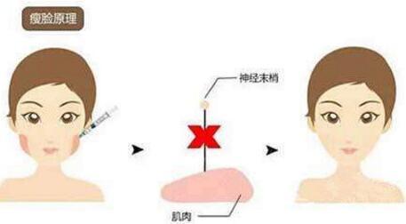 2023武漢隆胸材料取出醫(yī)院排行榜發(fā)布！武漢哪家整形醫(yī)院的推薦度高？