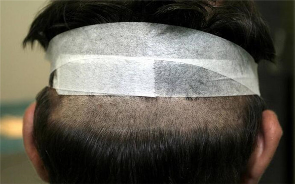 重慶哪家醫(yī)院豐唇口碑好？2023年榜單前十大整形美容醫(yī)院推薦！