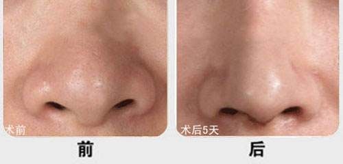 漳州有哪些性?xún)r(jià)比高的雙眼皮微創(chuàng)抽脂醫(yī)院？2023年漳州雙眼皮微創(chuàng)抽脂醫(yī)院排名前十更新！