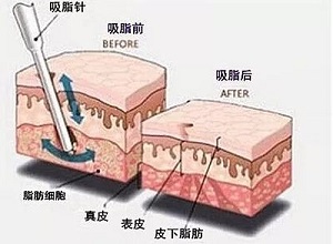 2023蕪湖鼻梁骨矯正醫(yī)院久負(fù)盛名，口碑贊譽(yù)不絕于耳！