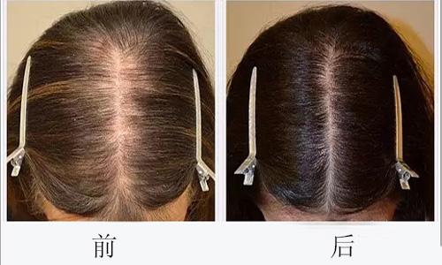 廣州哪些醫(yī)院可靠，專業(yè)進(jìn)行臉部疤痕切除整形美容？2023年十大排名公開！