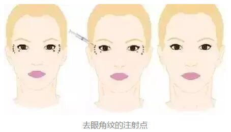 2023年北京鼻端缺損整形美容醫(yī)院前十強(qiáng)排名揭曉！知名度爆棚的醫(yī)療機(jī)構(gòu)盤點(diǎn)！