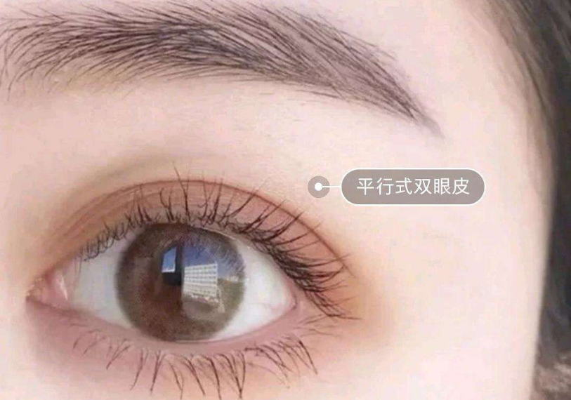 鄭州最受推崇的雙眼皮整形專家推薦榜單露臉！多位實力經驗高手霸占榜首！
