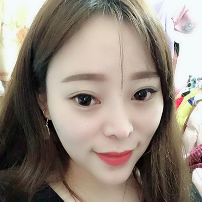 術(shù)前矮低平，術(shù)后高挺翹~肋軟骨隆鼻效果好的不得了！