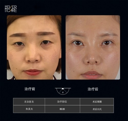 阿爾法9°美眼，打開(kāi)視界，美無(wú)止境