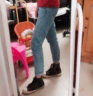 胖腿女孩兒福利分享：吸脂瘦大腿的蛻變，效果值得點贊！