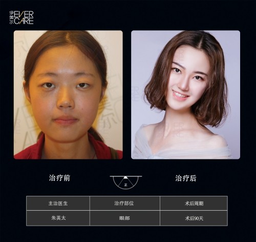 阿爾法9°美眼，打開視界，美無止境