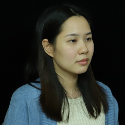 記錄我在廣州韓妃整形美容醫(yī)院眼綜合的手術(shù)經(jīng)歷，還有前后對(duì)比照片~