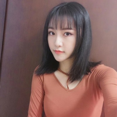 眼綜合術(shù)前VS術(shù)后，自然大眼睛值得稱贊！