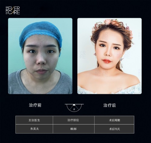 阿爾法9°美眼，打開(kāi)視界，美無(wú)止境