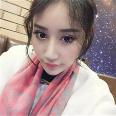 雙眼皮失敗丑的不敢見(jiàn)人，昆明麗都整形雙眼皮修復(fù)案例分享