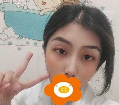 救命，周杰群做的耳軟骨隆鼻恢復(fù)后鼻背線條也太好看了吧