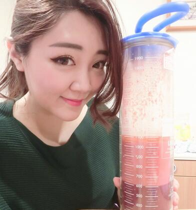 揭陽美萊整形手臂吸脂案例分享，輕松告別拜拜肉