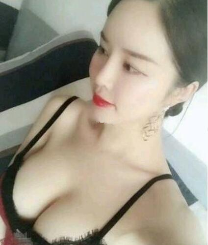 濟(jì)南海峽整形假體隆胸術(shù)后一個(gè)月