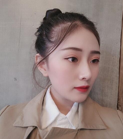 杭州時光磨骨前后對比，你整成這樣還缺王思聰嗎