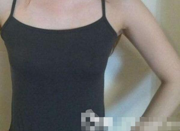吉安第二醫(yī)院妙桃假體隆胸案例，我一女的都賊喜歡
