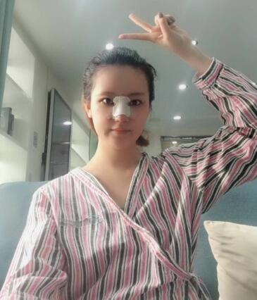 北京葉子整形肋軟骨隆鼻案例反饋，這鼻子是真實(shí)存在的嗎
